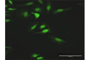 Image no. 4 for anti-Hemopoietic Cell Kinase (HCK) (AA 1-505) antibody (ABIN947963)