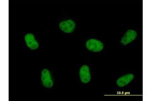 Image no. 1 for anti-Zinc Finger, CCHC Domain Containing 8 (ZCCHC8) (AA 1-707) antibody (ABIN527578)