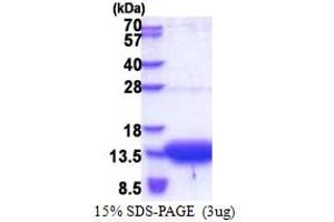 Image no. 1 for Organic Solute Transporter beta (OSTBETA) (AA 57-128) protein (His tag) (ABIN5853290)