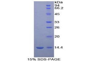 Image no. 1 for D-Aspartate Oxidase (DDO) protein (His tag) (ABIN1099030)