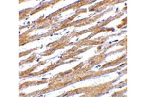 Image no. 1 for anti-CD274 (PD-L1) (Internal Region) antibody (ABIN6656633)