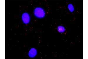 Image no. 6 for anti-Hematopoietic Cell-Specific Lyn Substrate 1 (HCLS1) (AA 266-355) antibody (ABIN516371)