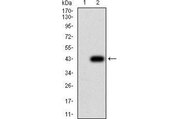 Keratin 10 antibody  (AA 345-454)