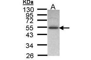 Image no. 1 for anti-Inositol Hexakisphosphate Kinase 2 (IP6K2) (AA 15-200) antibody (ABIN467499)