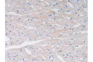 Cholecystokinin antibody  (AA 1-115)