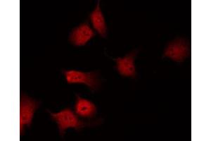 Image no. 2 for anti-FER Tyrosine Kinase (FER) (pTyr714) antibody (ABIN6271460)