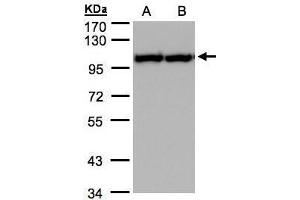 Image no. 5 for anti-Valosin Containing Protein (VCP) (C-Term) antibody (ABIN2854929)