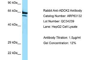 Image no. 1 for anti-AarF Domain Containing Kinase 2 (ADCK2) (C-Term) antibody (ABIN2789387)