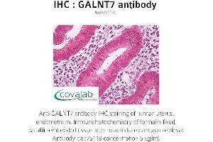 Image no. 1 for anti-UDP-N-Acetyl-alpha-D-Galactosamine:polypeptide N-Acetylgalactosaminyltransferase 7 (GalNAc-T7) (GALNT7) (full length) antibody (ABIN1734565)