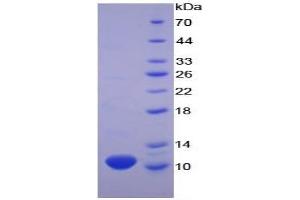 Image no. 3 for Pro-Platelet Basic Protein (Chemokine (C-X-C Motif) Ligand 7) (PPBP) ELISA Kit (ABIN6574153)