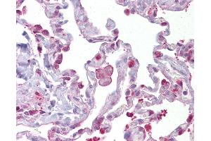 Image no. 2 for anti-Hematopoietic Prostaglandin D Synthase (HPGDS) (AA 35-84) antibody (ABIN958991)