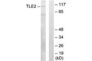 Image no. 1 for anti-Transducin-Like Enhancer Protein 2 (TLE2) (AA 211-260) antibody (ABIN1533832)