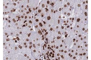 Image no. 1 for anti-Histone Deacetylase 8 (HDAC8) (pSer39) antibody (ABIN6255291)