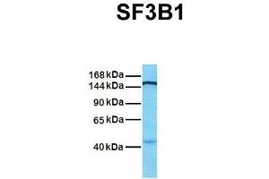 Image no. 5 for anti-Splicing Factor 3b, Subunit 1, 155kDa (SF3B1) (N-Term) antibody (ABIN2778700)