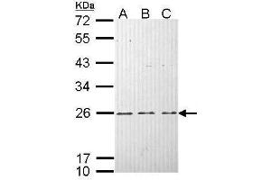 Image no. 4 for anti-HRas proto-oncogene, GTPase (HRAS) (C-Term) antibody (ABIN2857002)