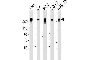 Image no. 2 for anti-Filamin A, alpha (FLNA) (AA 1-360) antibody (ABIN1882243)