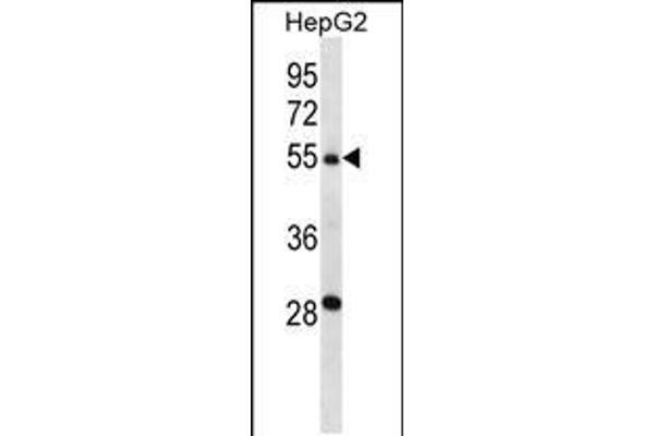 anti-Transmembrane Protease, Serine 13 (TMPRSS13) (AA 431-460), (C-Term) antibody