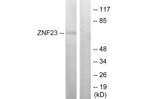 Western blot analysis of extracts from LOVO cells, using ZNF23 antibody.
