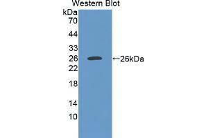 Image no. 2 for anti-Nephroblastoma Overexpressed (NOV) (AA 156-351) antibody (ABIN5013995)