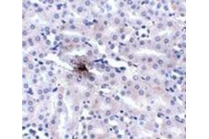 Immunohistochemistry of ZIP11 in mouse kidney tissue AP31005PU-N at 2.