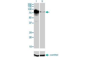 Image no. 4 for anti-Topoisomerase (DNA) III beta (TOP3B) (AA 1-862) antibody (ABIN563888)