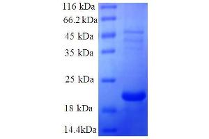 SDS-PAGE (SDS) image for Galectin 7 (LGALS7) (AA 2-136), (full length) protein (His tag) (ABIN1047044)