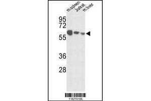 Image no. 1 for anti-Insulin-Like Growth Factor Binding Protein, Acid Labile Subunit (IGFALS) antibody (ABIN2489296)