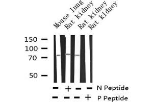 Image no. 15 for anti-Spleen tyrosine Kinase (SYK) (pTyr348) antibody (ABIN6255895)