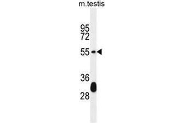 Keratin 33A Antikörper  (N-Term)