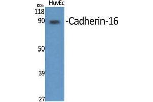 Image no. 2 for anti-Cadherin-16 (CDH16) (C-Term) antibody (ABIN3183612)