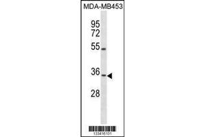Image no. 1 for anti-Osteopetrosis Associated Transmembrane Protein 1 (OSTM1) (AA 292-321), (C-Term) antibody (ABIN1537072)