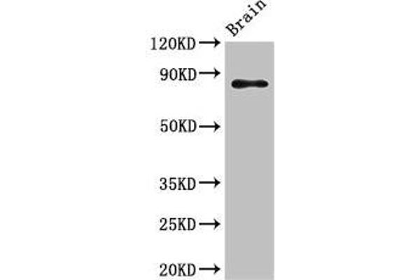 GIT1 antibody  (AA 470-642)