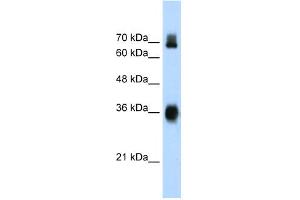 Image no. 1 for anti-Kelch-Like ECH-Associated Protein 1 (KEAP1) (C-Term) antibody (ABIN2775979)