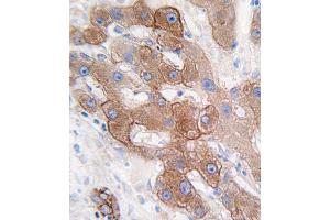 Immunohistochemistry (IHC) image for anti-Cytochrome P450, Family 3, Subfamily A, Polypeptide 5 (CYP3A5) antibody (ABIN2158459)