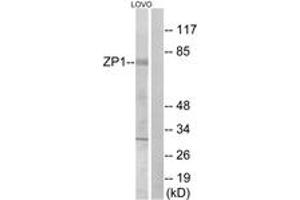 Image no. 1 for anti-Zona Pellucida Glycoprotein 1 (ZP1) (AA 221-270) antibody (ABIN1535493)