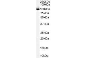 Image no. 3 for anti-Proteasome (Prosome, Macropain) 26S Subunit, Non-ATPase, 2 (PSMD2) (C-Term) antibody (ABIN185319)