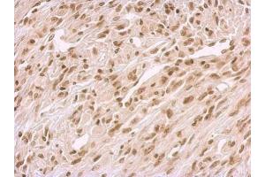 Image no. 2 for anti-BRCA2 and CDKN1A Interacting Protein (BCCIP) (C-Term) antibody (ABIN2856892)