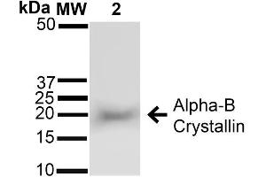 Image no. 4 for anti-Crystallin, alpha B (CRYAB) antibody (FITC) (ABIN2486810)