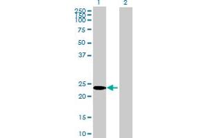 Western Blot analysis of SYT16 expression in transfected 293T cell line by SYT16 MaxPab polyclonal antibody.