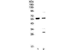 Western blot testing of 1) human COLO-320 and 2) human PANC-1 cell lysate with PDK1 antibody at 0.