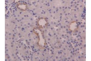 Image no. 3 for anti-Keratin 6A (KRT6A) (AA 323-461) antibody (ABIN1176074)