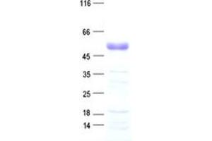 Image no. 1 for Pre-B-Cell Leukemia Homeobox 4 (PBX4) protein (His tag) (ABIN2728341)