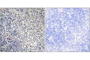 Image no. 1 for anti-P53-Regulated Apoptosis-Inducing Protein 1 (TP53AIP1) (AA 75-124) antibody (ABIN1534492)