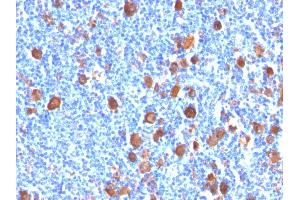 Image no. 4 for anti-Fascin (FSCN1) antibody (ABIN6940606)