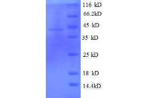 TBCC Protein (Tubulin Folding Cofactor C) (AA 2-345) (His tag)