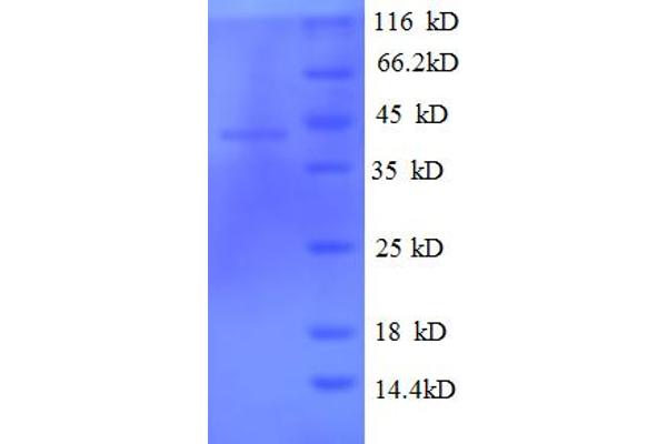 TBCC Protein (Tubulin Folding Cofactor C) (AA 2-345) (His tag)