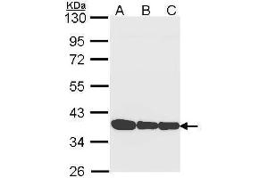 WB Image Sample (30 ug of whole cell lysate) A: A431 , B: H1299 C: Hela 10% SDS PAGE antibody diluted at 1:1000