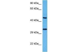 Image no. 2 for anti-SRY (Sex Determining Region Y)-Box 1 (SOX1) (N-Term) antibody (ABIN2780734)
