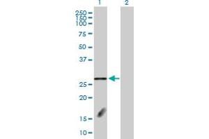 Image no. 3 for anti-F-Box and Leucine-Rich Repeat Protein 18 (FBXL18) (AA 1-259) antibody (ABIN529175)