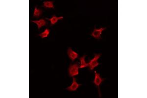 Image no. 1 for anti-PiggyBac Transposable Element Derived 1 (PGBD1) (Internal Region) antibody (ABIN6257414)